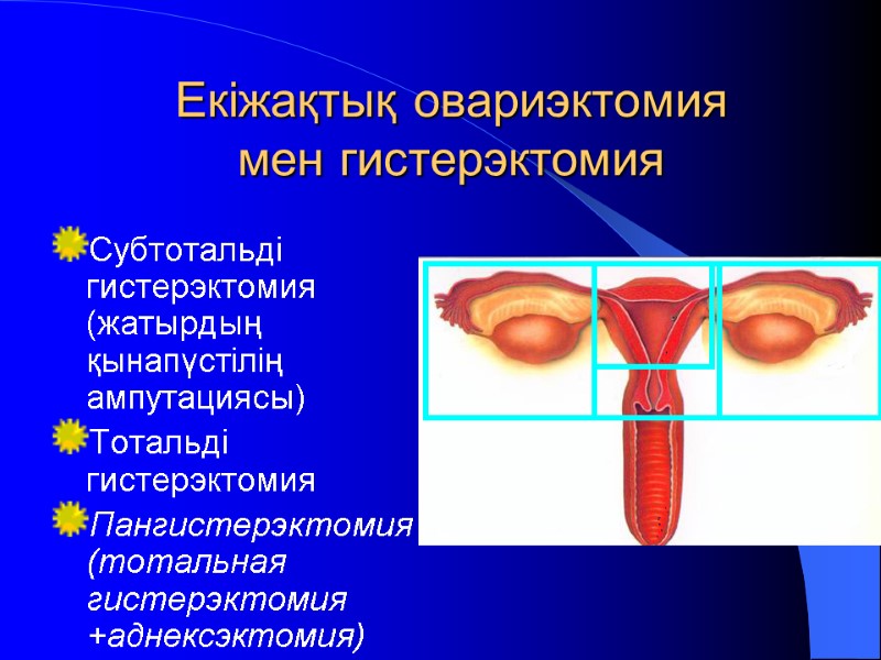 Екіжақтық овариэктомия мен гистерэктомия Субтотальді гистерэктомия (жатырдың қынапүстілің ампутациясы) Тотальді гистерэктомия  Пангистерэктомия (тотальная